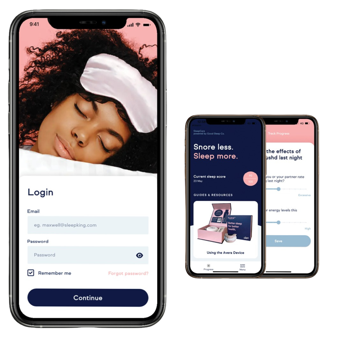 Hushd Avera Mandibular Advancement Splint (MAS)